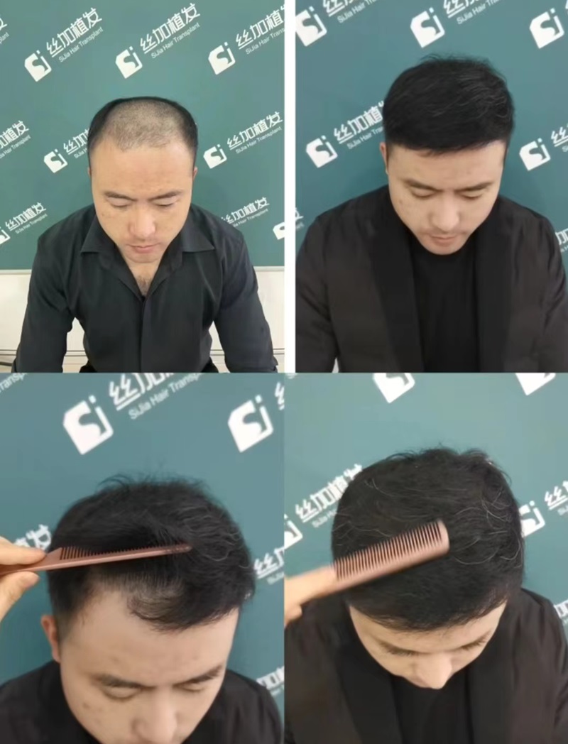 ʰţ׃󡪡ֲl(f)g(sh)(li)